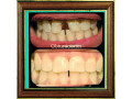tratamientos-dentales-small-2