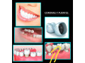 tratamientos-dentales-small-3