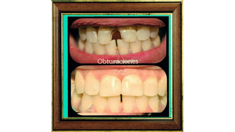 tratamientos-dentales-big-2