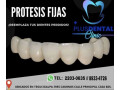 protesis-fija-small-0