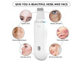 limpiador-electrico-ultrasonico-para-el-cuidado-facial-exfoliante-para-acne-y-poros-instrumento-de-belleza-small-5