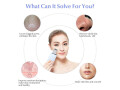 limpiador-electrico-ultrasonico-para-el-cuidado-facial-exfoliante-para-acne-y-poros-instrumento-de-belleza-small-1