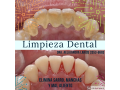limpieza-dental-small-0