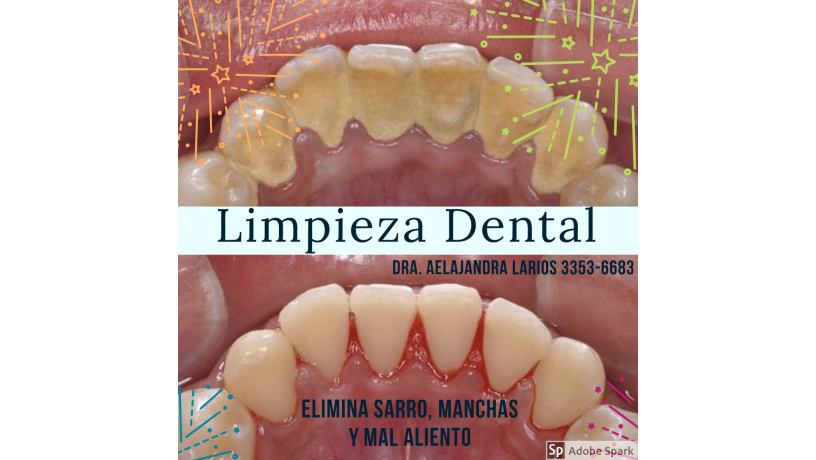 Borrar Novio consumo Limpieza dental, Tegucigalpa